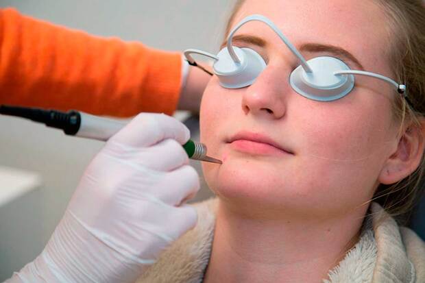 Laserbehandlung | Lasertherapie in Zürich